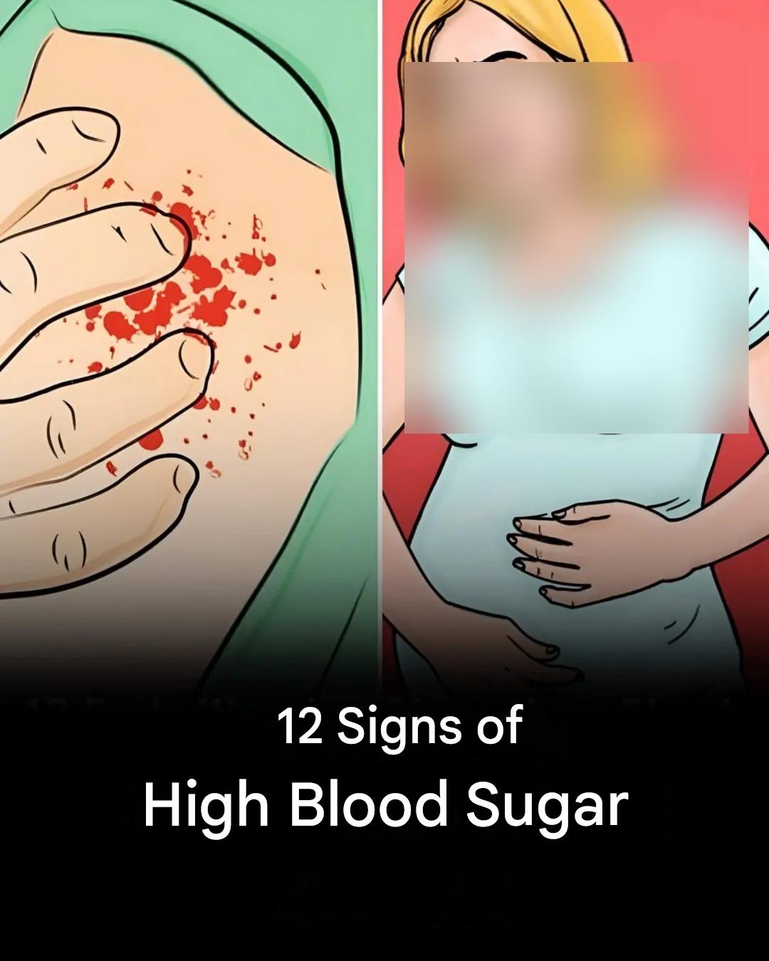 12 Warning Signs of High Blood Sugar Your Body May Be Showing Before It Becomes Dangerous