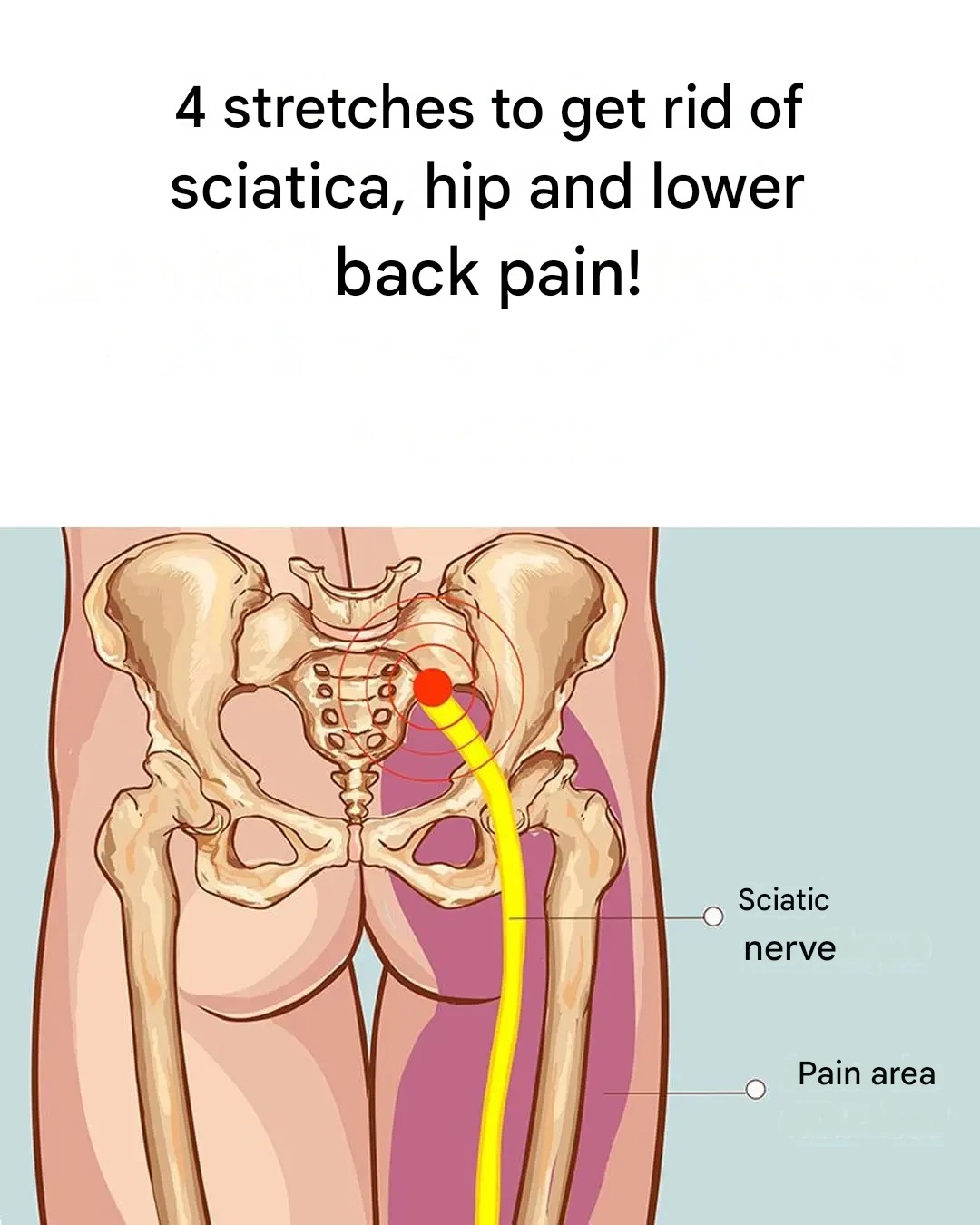 Sciatica Relief: 4 Simple Moves That Target the Hidden Muscle Secretly Triggering Your Pain
