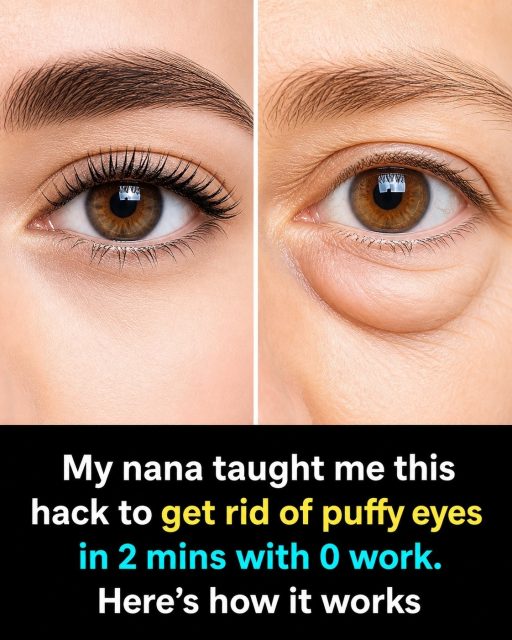 You Won’t Believe What 2 Minutes Can Do to Your Puffy Eyes…